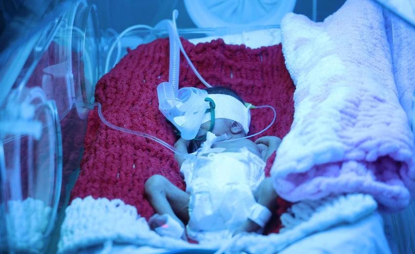Врачи-неонатологи спасли жизни двум маловесным недоношенным мальчикам. Каждый весил менее килограмма